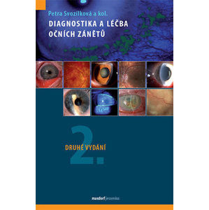 Diagnostika a léčba očních zánětů - Svozílková Petra a kolektiv