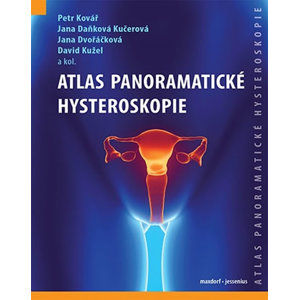 Atlas panoramatické hysteroskopie - Kovář Petr a kolektiv