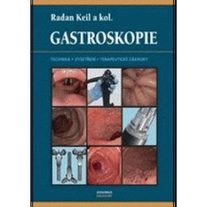 Gastroskopie - Keil Radan a kolektiv