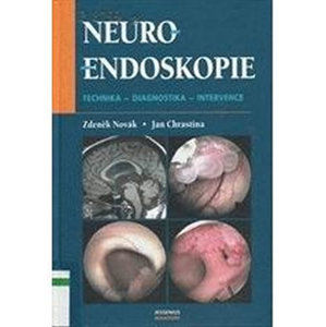 Neuroendoskopie - Novák Zdeněk, Chrastina Jan,