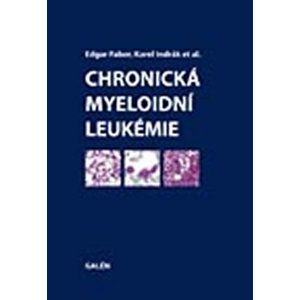Chronická myeloidní leukémie - Faber Edgar