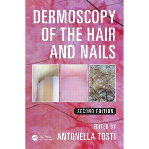 Dermoscopy of the Hair and Nails 2nd Edition - Tosti Antonella