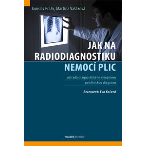 Jak na radiodiagnostiku nemocí plic - Polák Jaroslav, Vašáková Martina