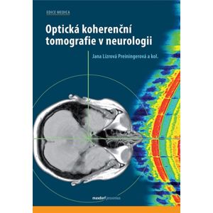 Optická koherenční tomografie v neurologii - Lízrová Preiningerová Jana