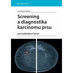 Screening a diagnostika karcinomu prsu pro každodenní praxi - Daneš Jan