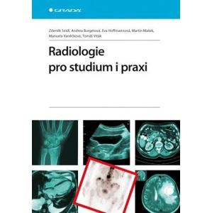 Radiologie pro studium i praxi - Seidl Zdeněk