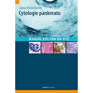 Cytologie pankreatu - Manuál EUS-FNA on site - Dvořáčková Jana